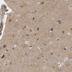 Invitrogen PDE1C Polyclonal Antibody 100 &mu;L; Unconjugated:Antibodies,
