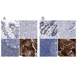 Invitrogen KLHL41 Polyclonal Antibody 100 &mu;L; Unconjugated:Antibodies,