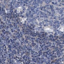 Invitrogen KLHL41 Polyclonal Antibody 100 &mu;L; Unconjugated:Antibodies,