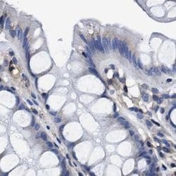 Invitrogen KLHL41 Polyclonal Antibody 100 &mu;L; Unconjugated:Antibodies,