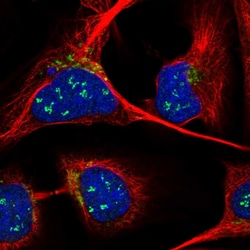 ANKRD40 Polyclonal Antibody:Antibodies, Polyclonal