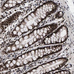 ANKRD40 Polyclonal Antibody:Antibodies, Polyclonal