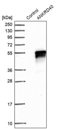 ANKRD40 Polyclonal Antibody:Antibodies, Polyclonal