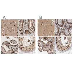 Invitrogen CBLL1 Polyclonal Antibody 100 &mu;L | Buy Online | Invitrogen&trade; | Fisher Scientific