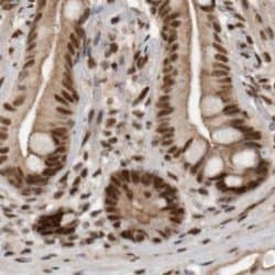 Invitrogen CBLL1 Polyclonal Antibody 100 &mu;L | Buy Online | Invitrogen&trade; | Fisher Scientific