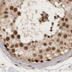 Invitrogen CBLL1 Polyclonal Antibody 100 &mu;L | Buy Online | Invitrogen&trade; | Fisher Scientific