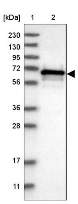 Invitrogen CBLL1 Polyclonal Antibody 100 &mu;L | Buy Online | Invitrogen&trade; | Fisher Scientific