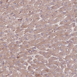 Invitrogen DENR Polyclonal Antibody 100 &mu;L; Unconjugated:Antibodies,