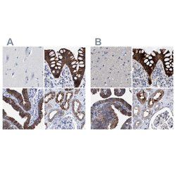 Invitrogen MKS1 Polyclonal Antibody 100 &mu;L; Unconjugated:Antibodies,