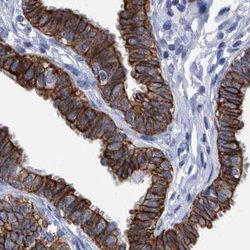 Invitrogen MKS1 Polyclonal Antibody 100 &mu;L; Unconjugated:Antibodies,