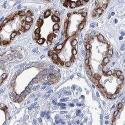 Invitrogen MKS1 Polyclonal Antibody 100 &mu;L; Unconjugated:Antibodies,