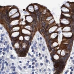 Invitrogen MKS1 Polyclonal Antibody 100 &mu;L; Unconjugated:Antibodies,