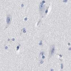 Invitrogen MKS1 Polyclonal Antibody 100 &mu;L; Unconjugated:Antibodies,