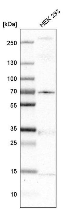 Invitrogen MKS1 Polyclonal Antibody 100 &mu;L; Unconjugated:Antibodies,