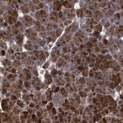 Invitrogen ABCF2 Polyclonal Antibody 100 &mu;L; Unconjugated:Antibodies,
