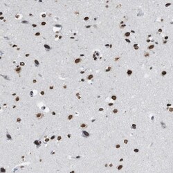Invitrogen NUP88 Polyclonal Antibody 100 &mu;L; Unconjugated:Antibodies,