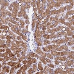 Invitrogen HSD17B2 Polyclonal Antibody 100 &mu;L; Unconjugated:Antibodies,