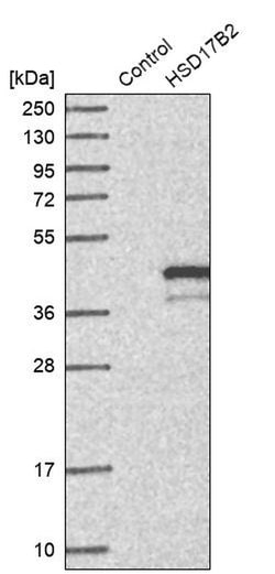 Invitrogen HSD17B2 Polyclonal Antibody 100 &mu;L; Unconjugated:Antibodies,