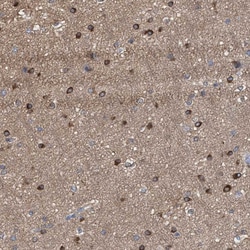 Invitrogen FHOD3 Polyclonal Antibody 100 &mu;L; Unconjugated:Antibodies,