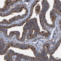 Invitrogen LRSAM1 Polyclonal Antibody 100 &mu;L; Unconjugated:Antibodies,
