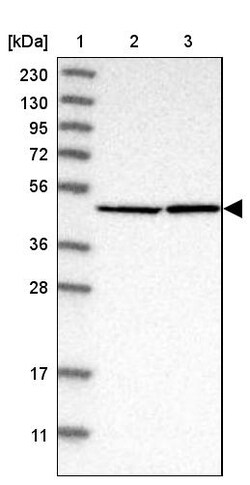 Invitrogen eIF4A3 Polyclonal Antibody 100 &mu;L; Unconjugated:Antibodies,