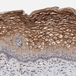 Invitrogen CYSRT1 Polyclonal Antibody 100 &mu;L | Buy Online | Invitrogen&trade; | Fisher Scientific