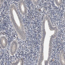 Invitrogen CYSRT1 Polyclonal Antibody 100 &mu;L | Buy Online | Invitrogen&trade; | Fisher Scientific
