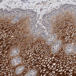 Invitrogen CYSRT1 Polyclonal Antibody 100 &mu;L | Buy Online | Invitrogen&trade; | Fisher Scientific