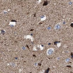 Invitrogen MECR Polyclonal Antibody 100 &mu;L | Buy Online | Invitrogen&trade; | Fisher Scientific