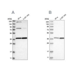 Invitrogen MECR Polyclonal Antibody 100 &mu;L | Buy Online | Invitrogen&trade; | Fisher Scientific