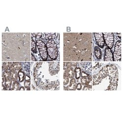 Invitrogen MECR Polyclonal Antibody 100 μL; Unconjugated:Antibodies,