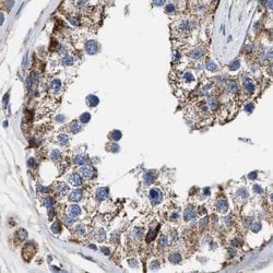 Invitrogen MECR Polyclonal Antibody 100 μL; Unconjugated:Antibodies,