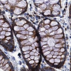 Invitrogen MECR Polyclonal Antibody 100 μL; Unconjugated:Antibodies,