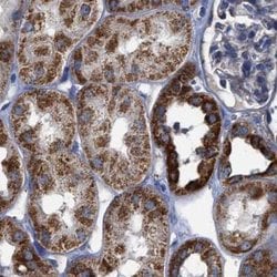 Invitrogen MECR Polyclonal Antibody 100 μL; Unconjugated:Antibodies,