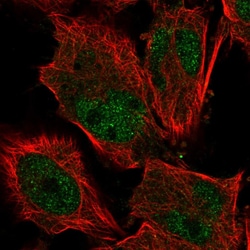 Invitrogen KIF9 Polyclonal Antibody 100 &mu;L; Unconjugated:Antibodies,