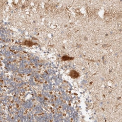 Invitrogen KIF9 Polyclonal Antibody 100 &mu;L; Unconjugated:Antibodies,
