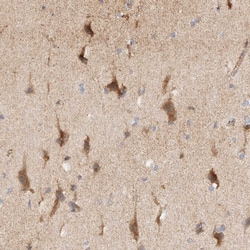 Invitrogen KIF9 Polyclonal Antibody 100 &mu;L; Unconjugated:Antibodies,
