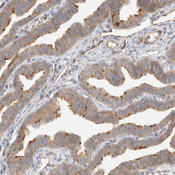 Invitrogen KIF9 Polyclonal Antibody 100 &mu;L; Unconjugated:Antibodies,