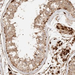 Invitrogen KIF9 Polyclonal Antibody 100 &mu;L; Unconjugated:Antibodies,