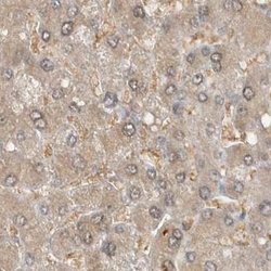 MPRIP Polyclonal Antibody:Antibodies, Polyclonal