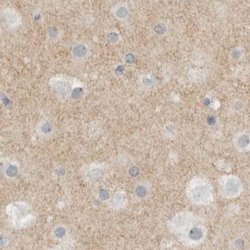 MPRIP Polyclonal Antibody:Antibodies, Polyclonal