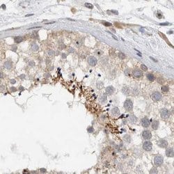 MPRIP Polyclonal Antibody:Antibodies, Polyclonal