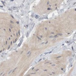 MPRIP Polyclonal Antibody:Antibodies, Polyclonal