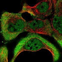 NKTR Polyclonal Antibody:Antibodies, Polyclonal