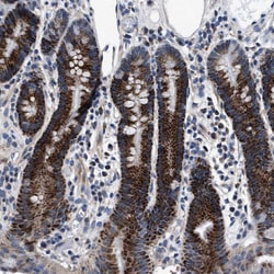 NKTR Polyclonal Antibody:Antibodies, Polyclonal