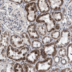 NKTR Polyclonal Antibody:Antibodies, Polyclonal
