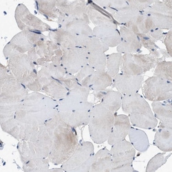 NKTR Polyclonal Antibody:Antibodies, Polyclonal