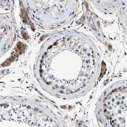 NKTR Polyclonal Antibody:Antibodies, Polyclonal