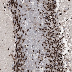 Invitrogen 53BP1 Polyclonal Antibody 100 &mu;L | Buy Online | Invitrogen&trade; | Fisher Scientific