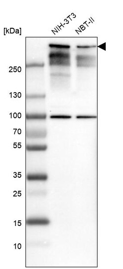 Invitrogen 53BP1 Polyclonal Antibody 100 &mu;L | Buy Online | Invitrogen&trade; | Fisher Scientific